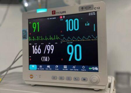 معرفی جامع انواع مانیتورینگ علائم حیاتی: از پایش ساده تا مراقبت‌های ویژه