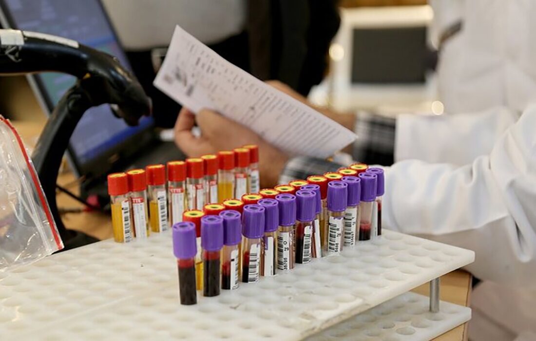 از اهداکنندگان تا هوش مصنوعی؛ اولویت‌های پژوهشی جدید در انتقال خون