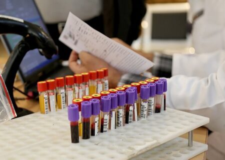 از اهداکنندگان تا هوش مصنوعی؛ اولویت‌های پژوهشی جدید در انتقال خون