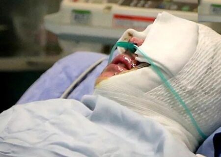 شاکی دریادل از قصاص گذشت / آزادی زن اسیدپاش پس از سال‌ها زندان