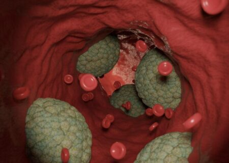 برخی حملات قلبی شاید نتیجه‌ی فعالیت میکروب‌ها باشد