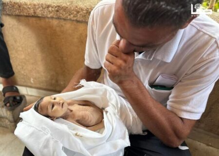 شهادت ۳ نفر در غزه در پی گرسنگی و سوء تغذیه