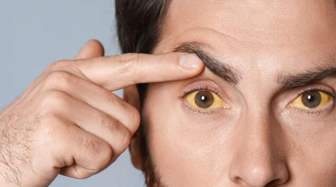 عوامل افزایش کلسترول در دهههای ۲۰ و ۳۰