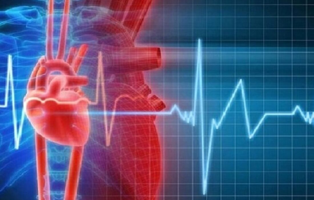 همه حملههای قلبی به گرفتگی رگها مربوط نیست!