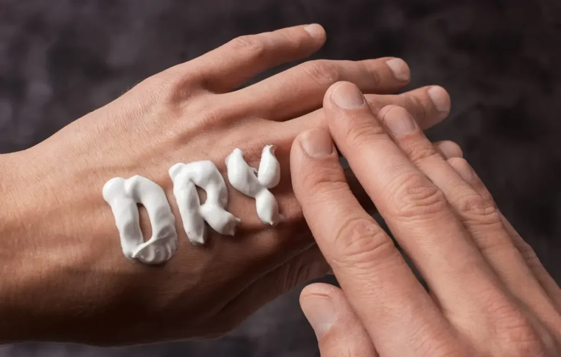 چگونه از خشکی پوست در پاییز جلوگیری کنیم؟