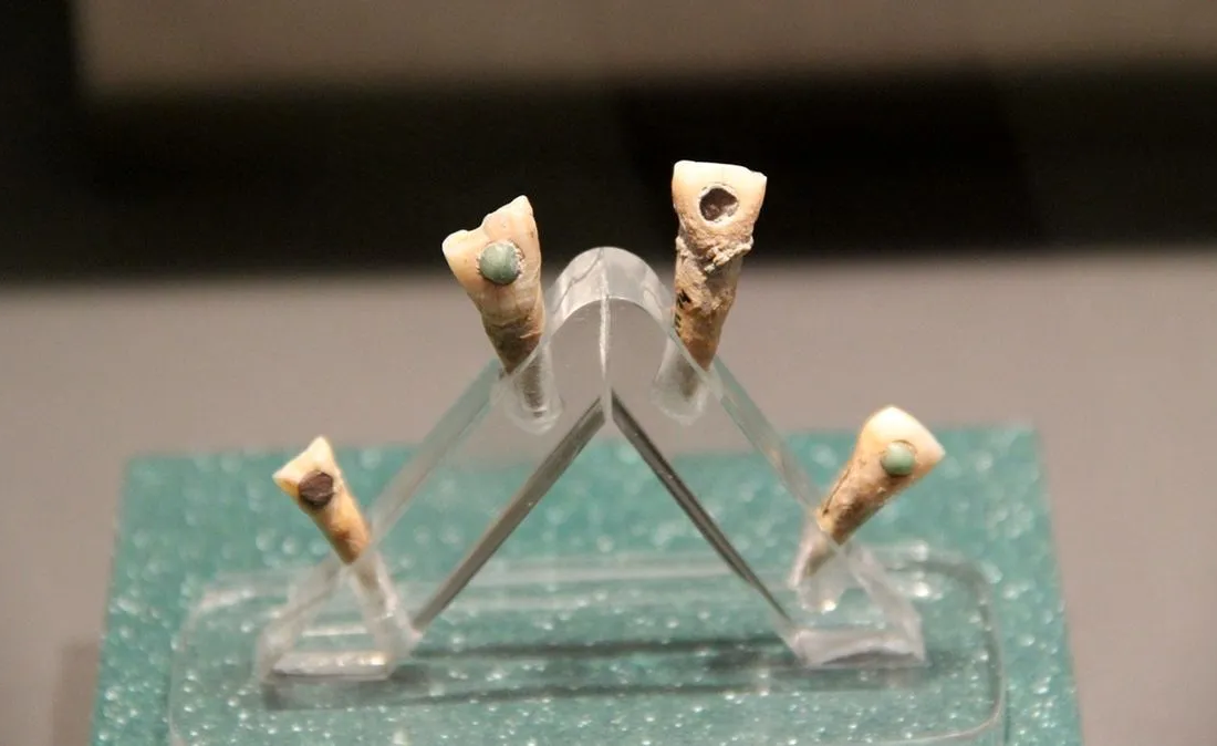 کشف دندان‌ هایی با نگین یشم که متعلق به یک کودک هفت ساله بوده‌اند