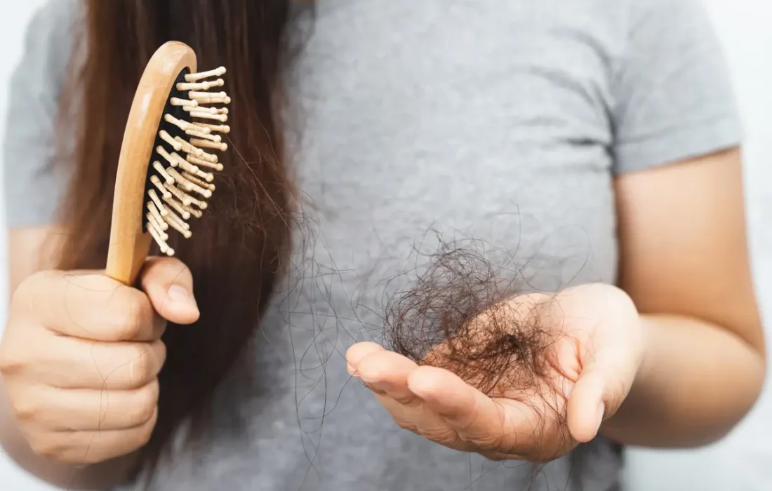 با این 4 عادت ساده، جلوی ریزش موهات رو بگیر!