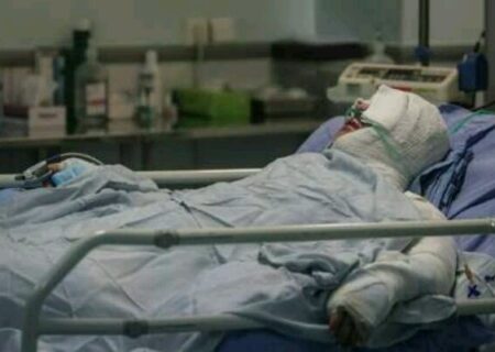 بیمارستان سوختگی طالقانی اهواز در آستانه دستیابی به مرزهای نوین پزشکی