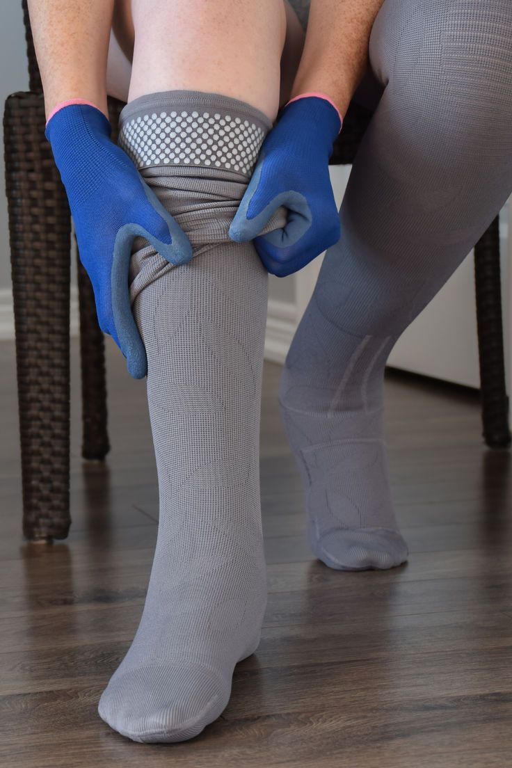 جورابهای واریس و نقش آنها در بهبود گردش خون