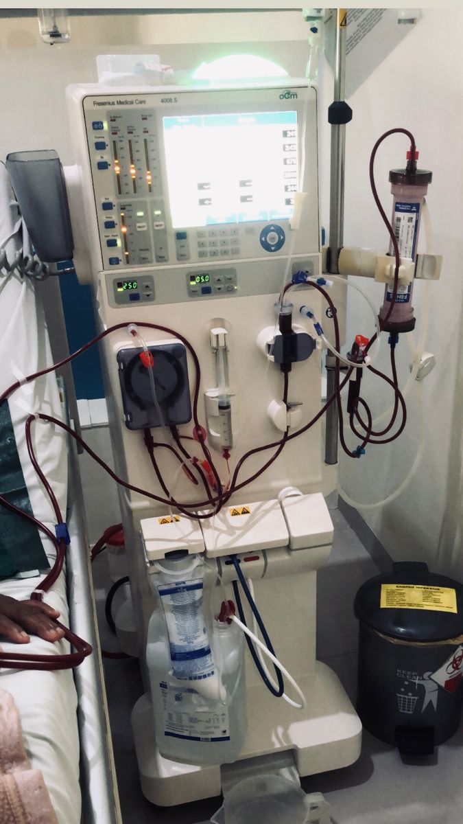 دستگاه دیالیز و نحوه عملکرد آن