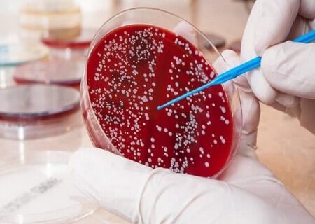 تشخیص سریع سرطان خون با اختراع پژوهشگران شیرازی