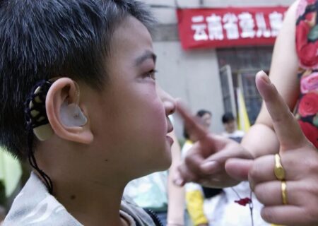 ۱۳ درصد معلولان بهزیستی زنجان دچار اختلال شنوایی هستند