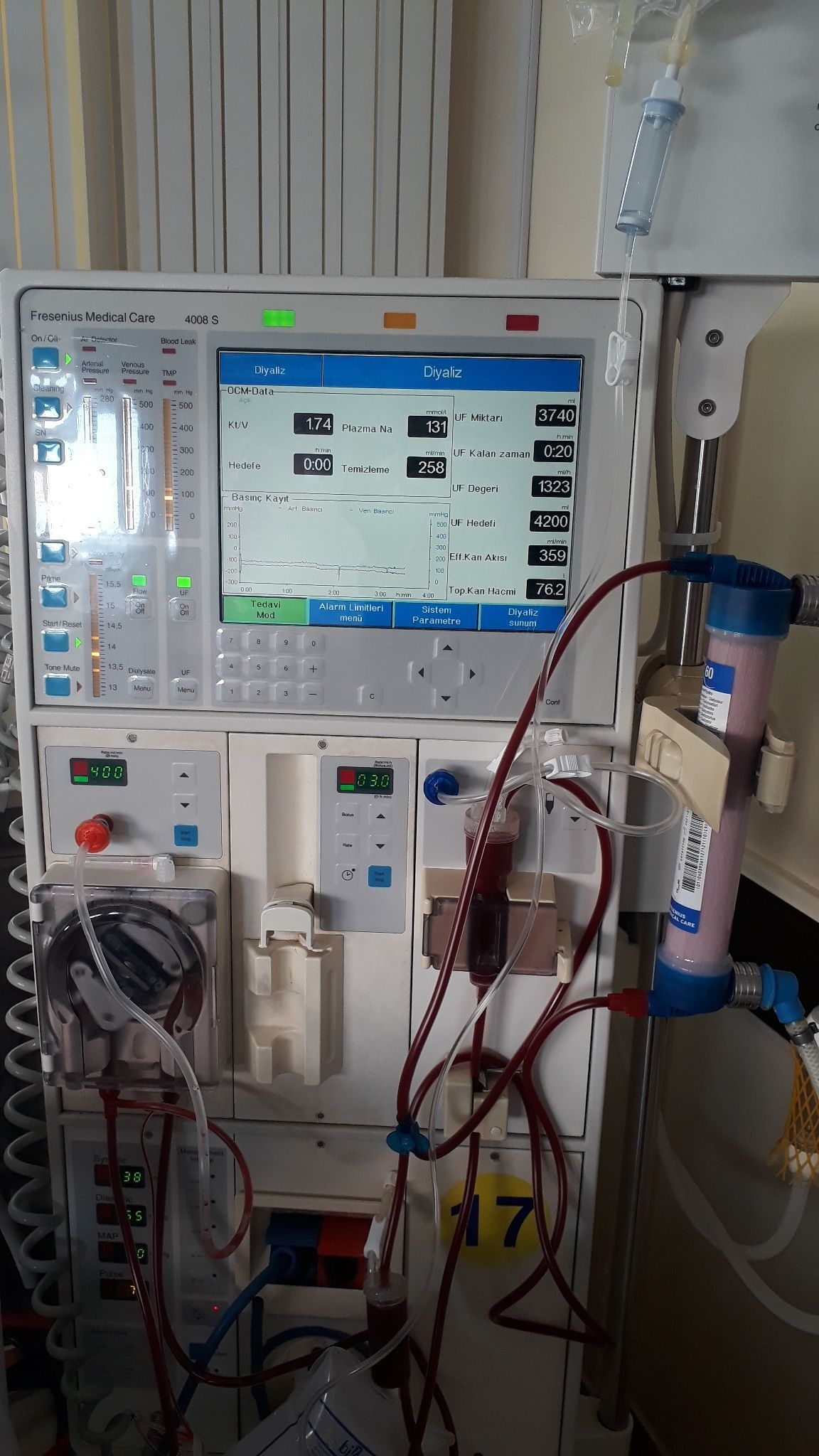 دستگاه دیالیز و نحوه عملکرد آن