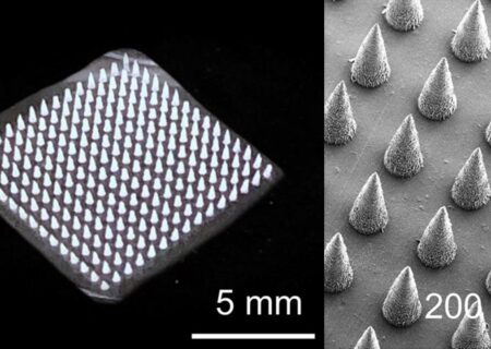 نوآوری ایرانی در نانو؛ تحول تولید میکرونیدل‌های تجزیه‌پذیر