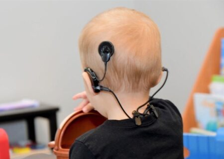 ۹۸ مددجوی بهزیستی در انتظار تامین اعتبار برای عمل کاشت حلزون