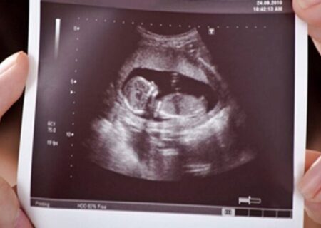 بیمه تکمیلی حامی مکمل‌های ناباروری در خراسان شمالی/ سهم ۱۰ میلیونی بیماران نابارور در بعضی نسخه‌ها