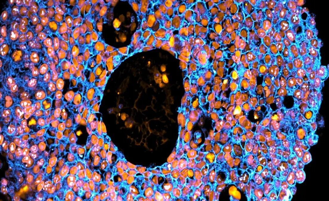 چاپ سه بعدی جفت انسانی برای بررسی چالشهای بارداری