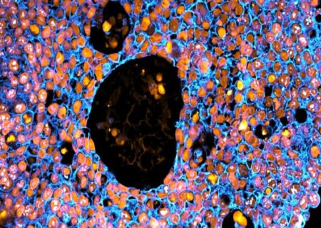 چاپ سه بعدی جفت انسانی برای بررسی چالش‌های بارداری