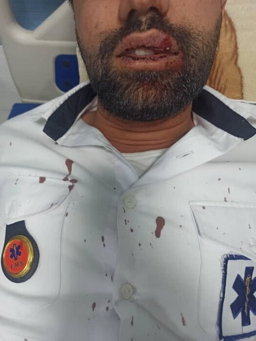 حمله به تکنسینهای اورژانس در این استان غربی