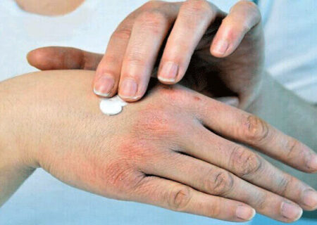 راهکارهای ساده برای جلوگیری از خشکی پوست در پاییز