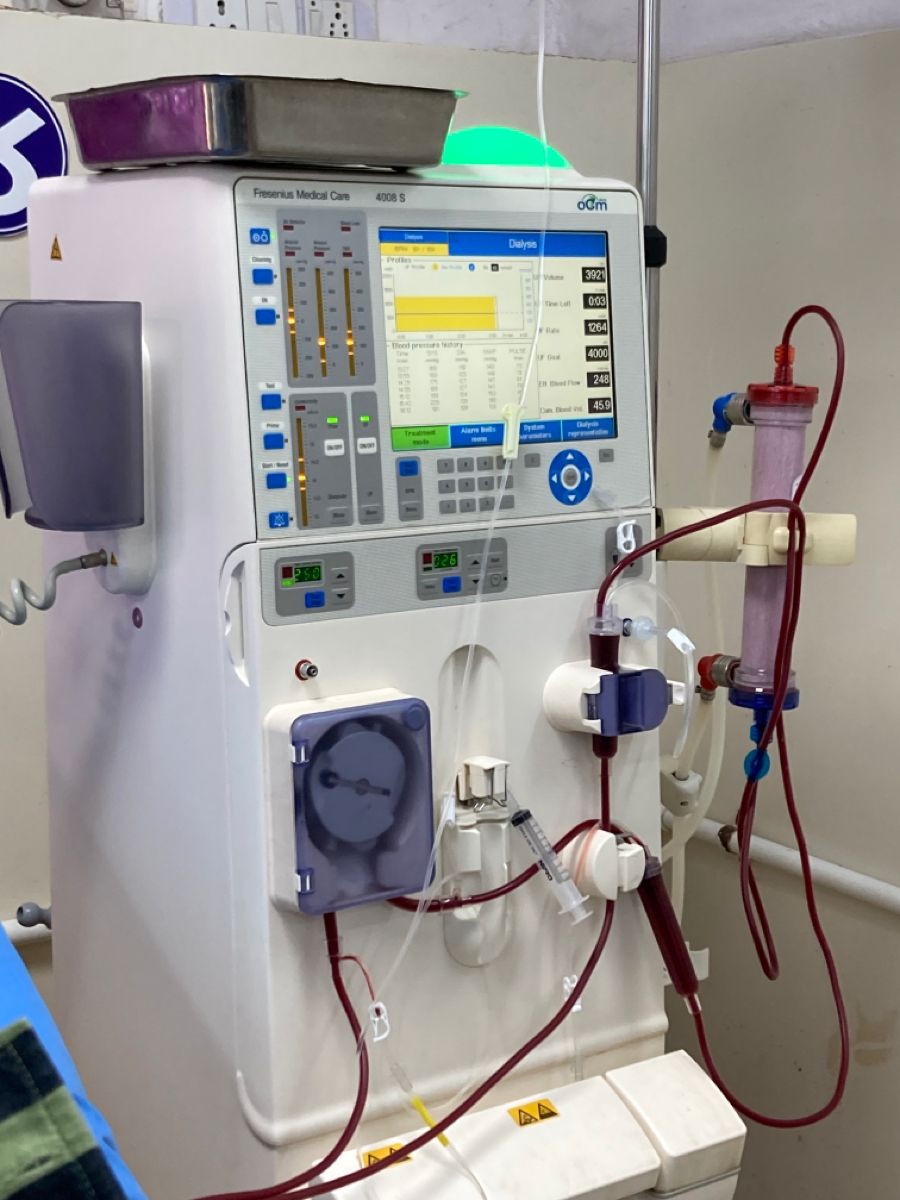 دستگاه دیالیز و نحوه عملکرد آن