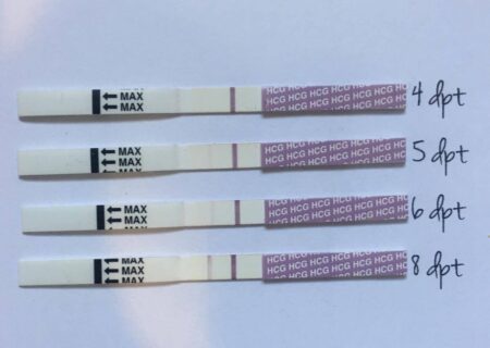 راهنمای کامل نوارهای تست بارداری: از نحوه عملکرد تا نکات کلیدی برای استفاده