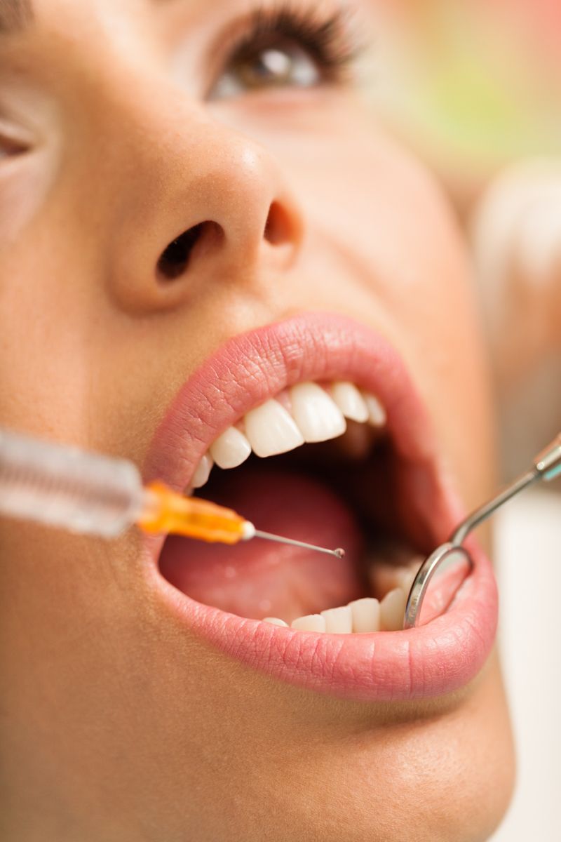 راهنمای جامع سرنگ بی‌حسی دندانپزشکی و انواع آن