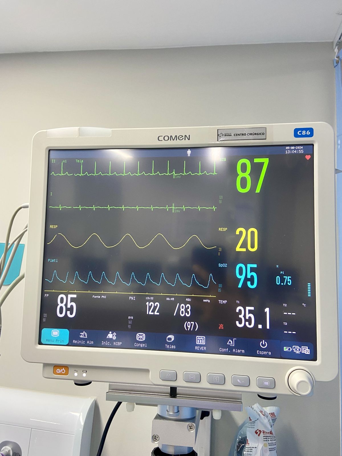 معرفی جامع انواع مانیتورینگ علائم حیاتی: از پایش ساده تا مراقبت‌های ویژه