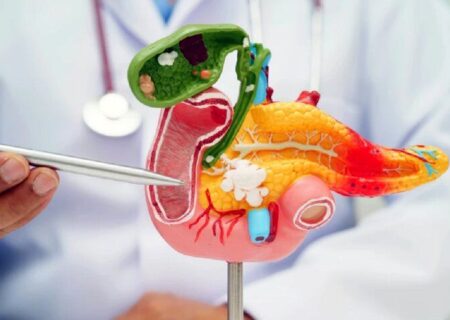 نقطه ضعف سرطان لوزالمعده کشف شد