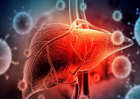 بی تحرکی و چاقی؛ جاده یک طرفه به سوی سیروز کبدی