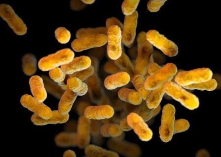 نکاتی درباره یک بیماری باکتریایی