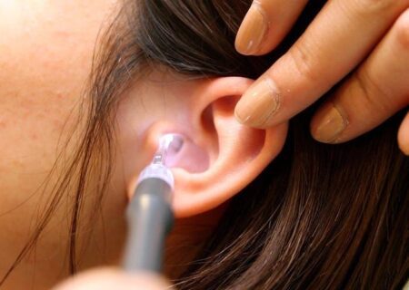 انواع گوش‌پاک‌کن‌های ایمن پزشکی