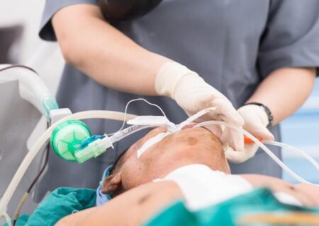 لوله تراشه در بیهوشی: مجرای حیاتی برای تنفس ایمن