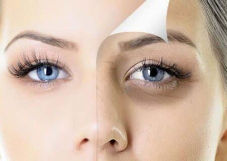 جراحی زیبایی چشم: راهنمای کامل بلفاروپلاستی و روش‌های مرتبط