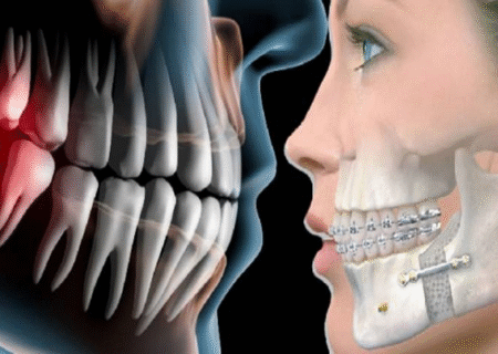 راهنمای جامع فک: از آناتومی و عملکرد تا بیماری‌ها و نکات بهداشت دهان و دندان