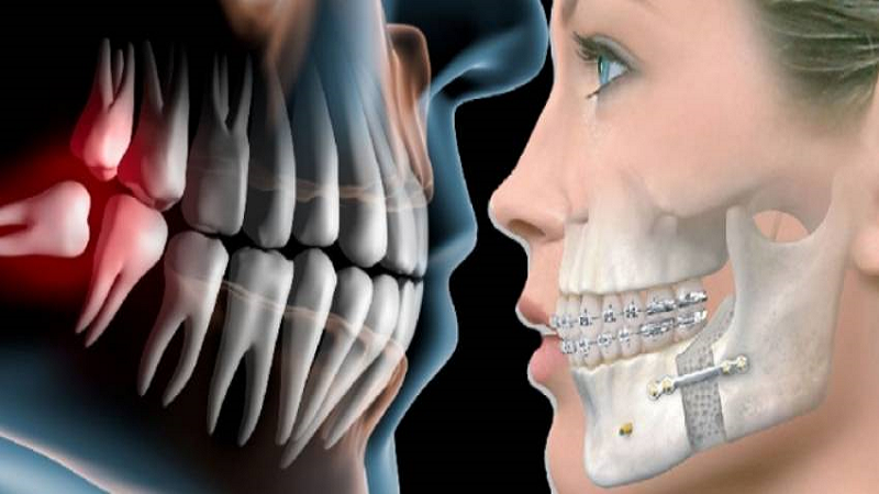 راهنمای جامع فک