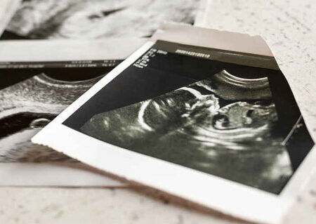 خدمات سقط درمانی: بررسی ابعاد قانونی، پزشکی و حمایتی