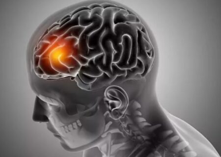 چربی خطرناک، تهدیدی جدی برای تسریع روند پیری مغز