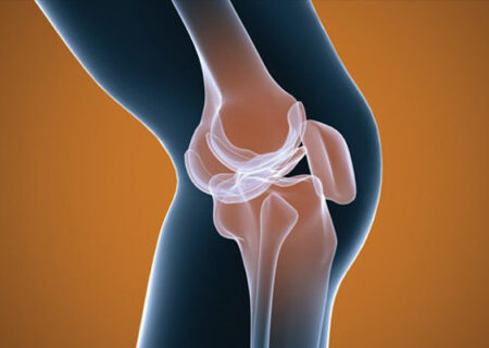 علت درد ران موقع راه رفتن چیست؟