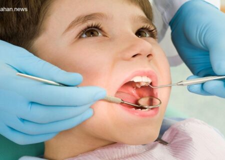 پوسیدگی دندان گریبانگیر ۹۰ درصد کودکان زیر ۷ سال