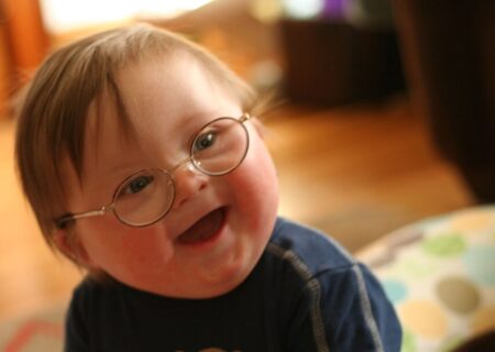 تکذیب افزایش ۲.۵ برابری آمار تولد نوزادان با اختلالات کروموزومی