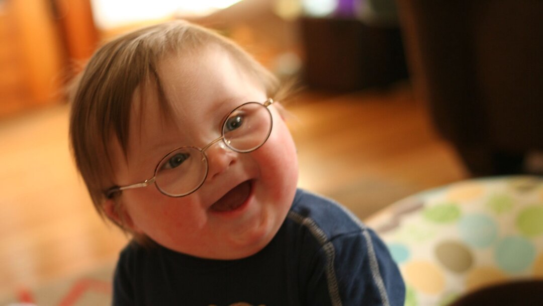 تکذیب افزایش ۲.۵ برابری آمار تولد نوزادان با اختلالات کروموزومی