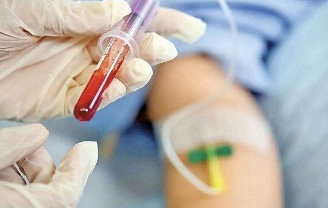 دیگر نیازی به سفر نیست؛ انجام آزمایشهای تخصصی هموفیلی در کرمانشاه