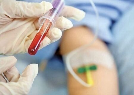 دیگر نیازی به سفر نیست؛ انجام آزمایش‌های تخصصی هموفیلی در کرمانشاه