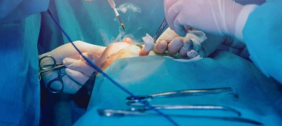 جراحی پروتز: راهی نوین برای بهبود کیفیت زندگی