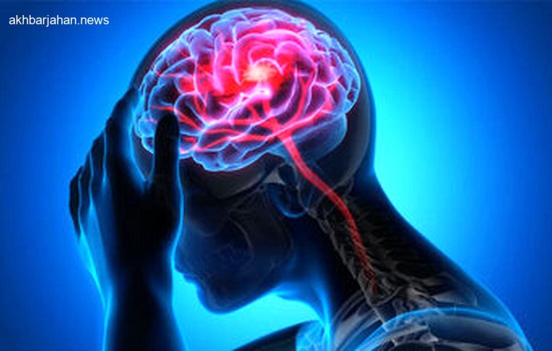 فرصت حیاتی برای درمان بیماران سکته مغزی