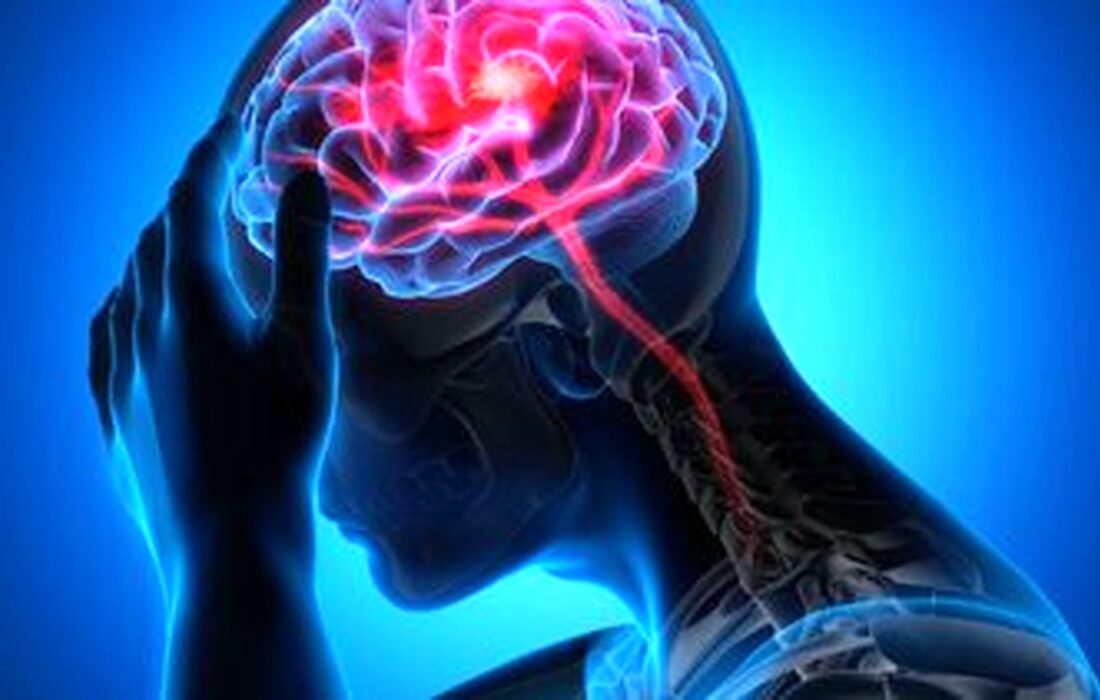 سکته در کمین ایرانیان؛ ۱۰ سال زودتر از میانگین جهانی