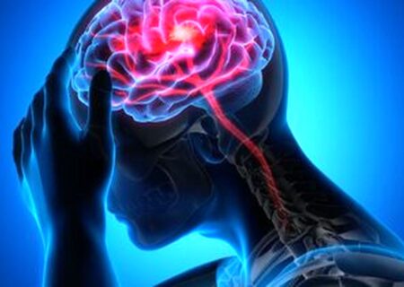 سکته در کمین ایرانیان؛ ۱۰ سال زودتر از میانگین جهانی