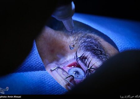 چشم آبی به قیمت نابینایی