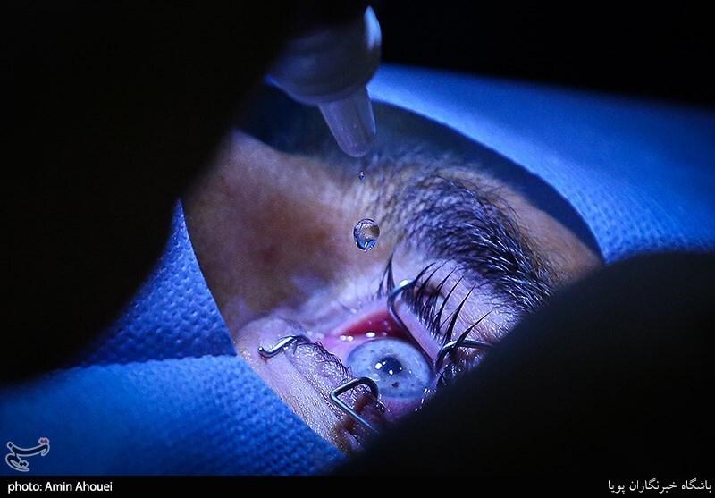 چشم آبی به قیمت نابینایی